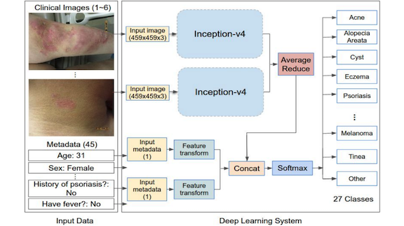 Overview of the development and validation of our deep learning system (DLS)